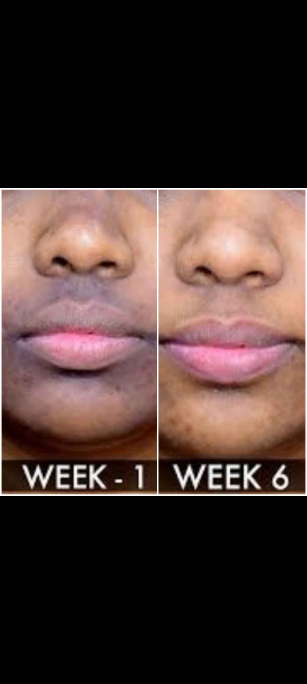 skin lightening cream