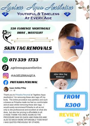 Skin Tag Removal Solution