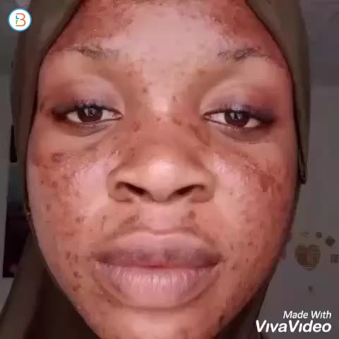 clear that face ☺️