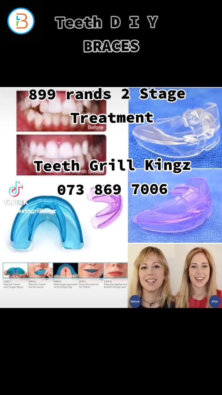 Teeth Braces DIY

R899 each

ON SPECIAL for this week